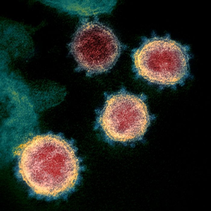 Schockierend! Sars-CoV-2 kann Nervensystem angreifen Schockierend! Sars-CoV-2 kann Nervensystem angreifen (Foto)