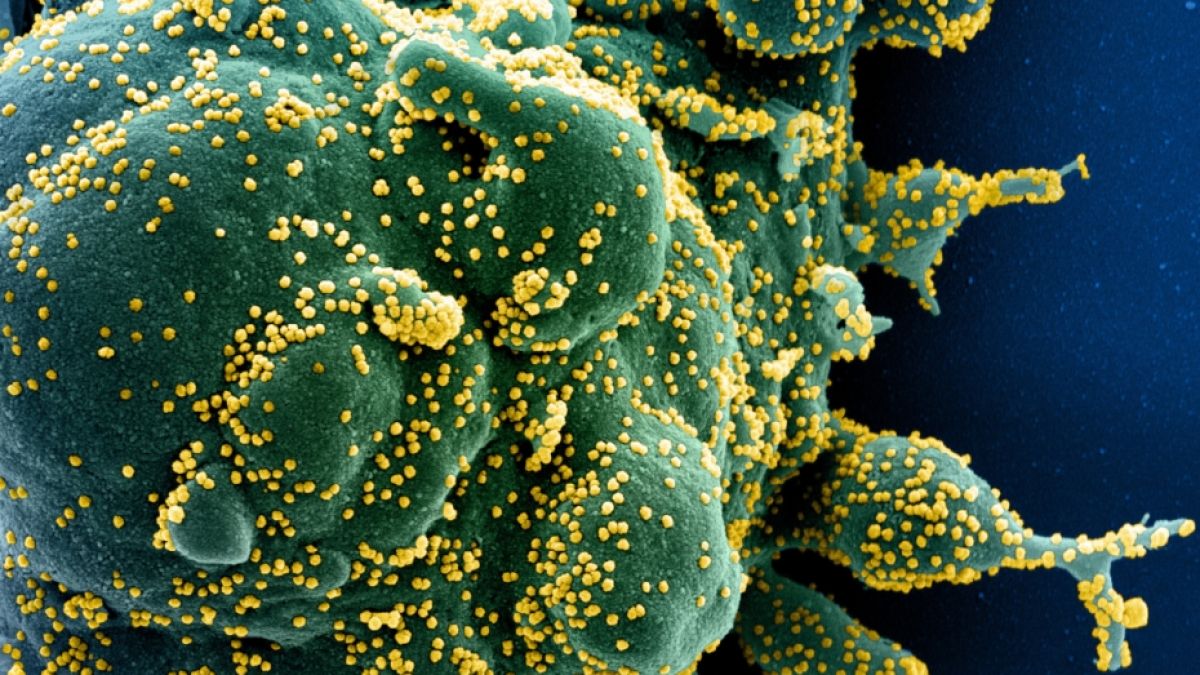 Ein Forscherteam aus den USA und China befürchtet, dass das Coronavirus ähnlich aggressiv wie HIV wüten kann und das Immunsystem nachhaltig schädigen könnte. (Foto)