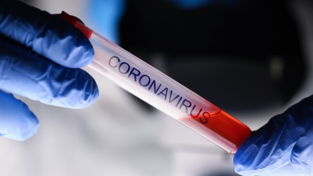Stammt das Coronavirus aus einem Labor? (Foto)