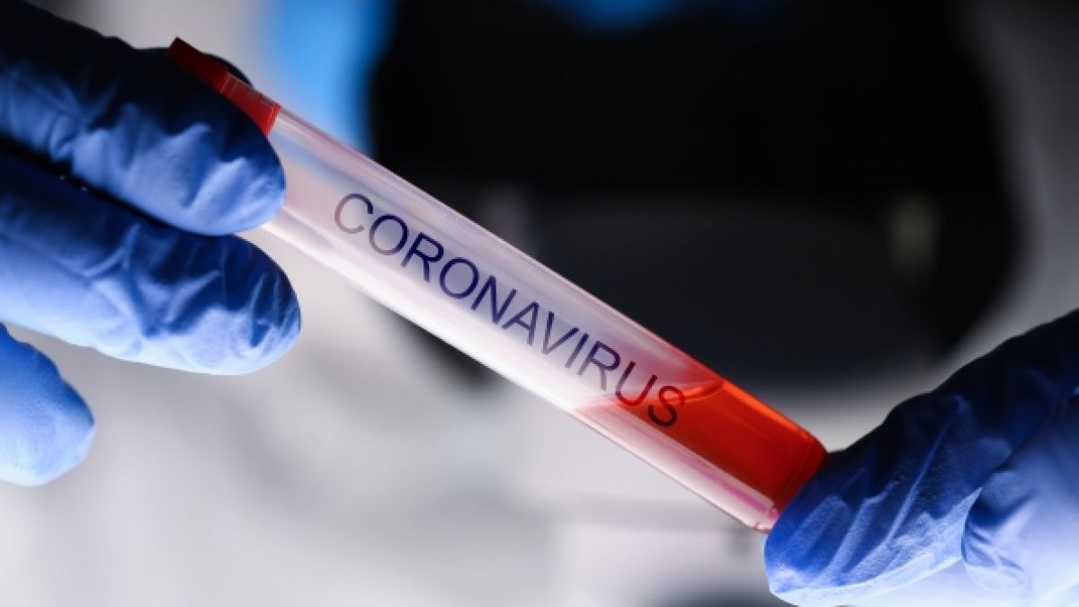 Ein Professor behauptet, das Coronavirus würde ohne Eingreifen verschwinden. (Foto)