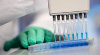 Ein neuartiger Coronavirus-Antikörpertest soll in Deutschland noch im Mai in millionenfacher Ausfertigung verfügbar sein.