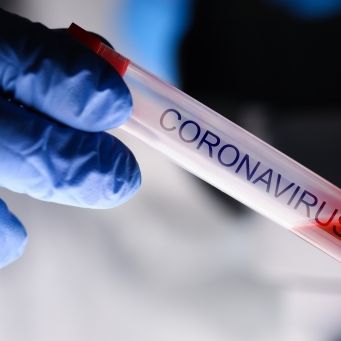 Sensation! Kann DIESER Test die Virus-Ausbreitung stoppen? Sensation! Kann DIESER Test die Virus-Ausbreitung stoppen? (Foto)