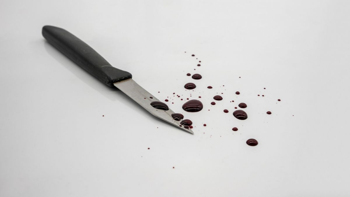 Bei einer Messerattacke in Essen wurde eine Frau schwer verletzt. (Foto)