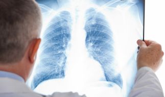 Dr Johannes Wimmer Schwerkranke Tochter Dafur Wurde Sich Der Tv Arzt Opfern News De