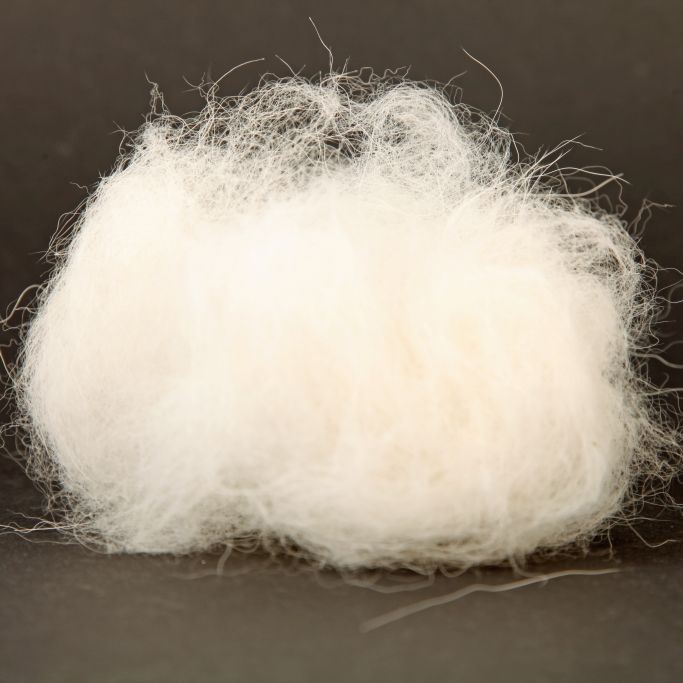 Ärzte holen 7-Kilo-Haarball aus Teenager-Magen (Foto)