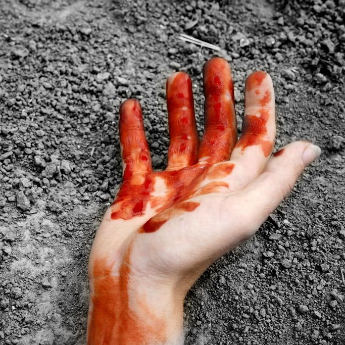 Nacktes Entführungsopfer mit abgetrennter Hand geflohen