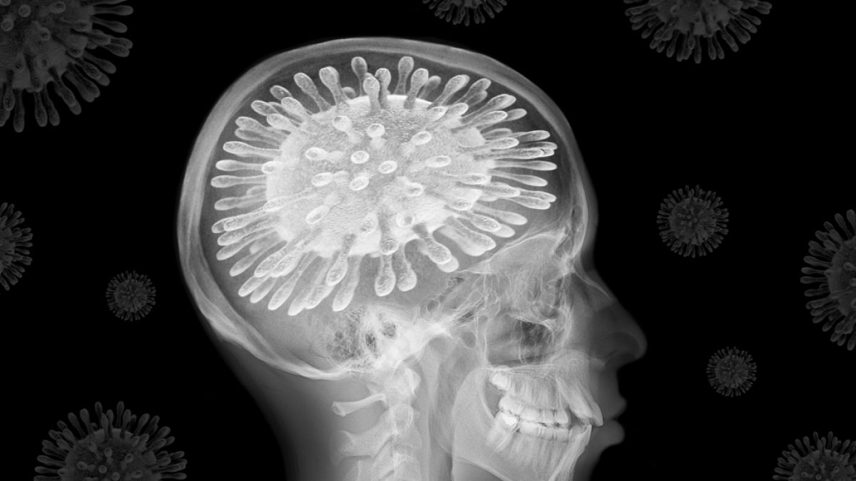 Laut einer neuen Studie nimmt durch eine Coronavirus-Infektion die Gehirnleistung ab. (Symbolfoto) (Foto)