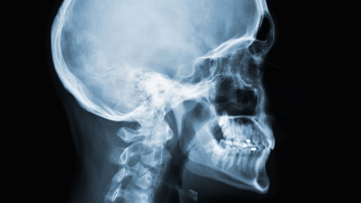 Wie gefährlich sind Röntgenstrahlen für den Körper? (Foto)