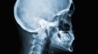 Wie gefährlich sind Röntgenstrahlen für den Körper?