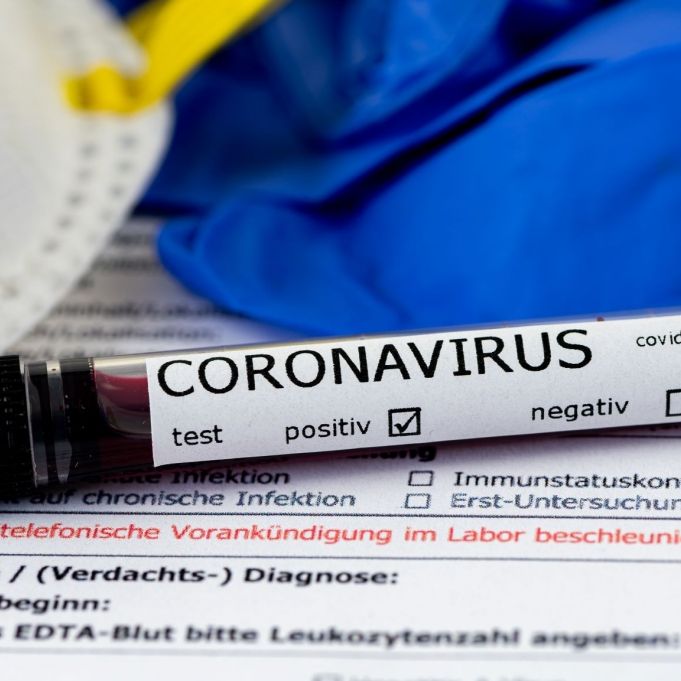 Studien-Sensation! Schützt eine Corona-Infektion länger als eine Impfung?
