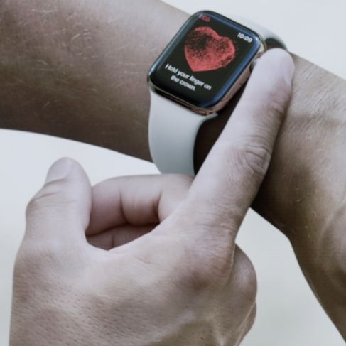 Durchbruch im Corona-Kampf: Apple Watch kann Corona früh erkennen!