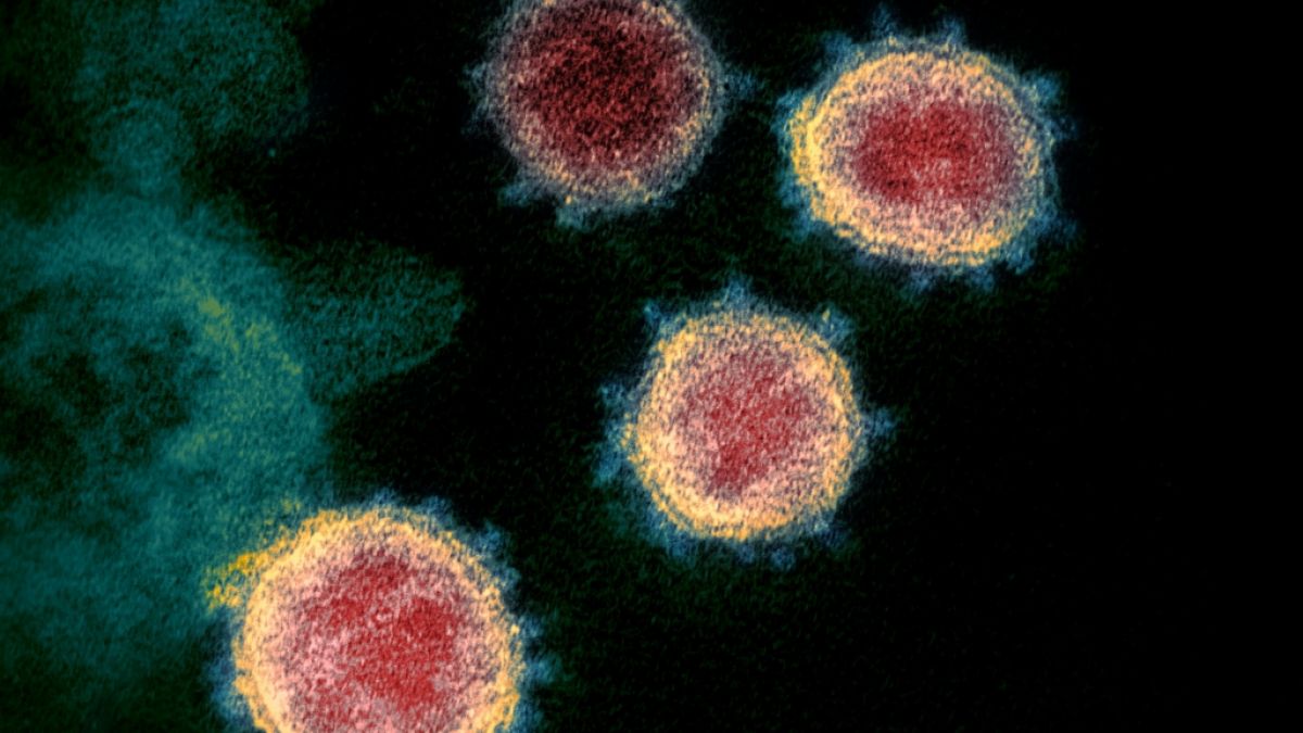 Das Coronavirus - hier eine elektronenmikroskopische Aufnahme des Erregers Sars-CoV-2 - bildet unentwegt neue Varianten durch Mutationen aus. (Foto)