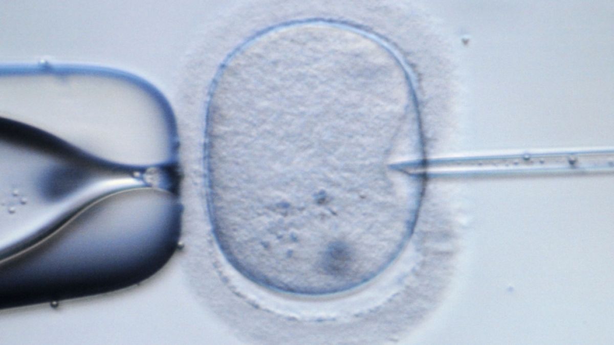 Einem internationalen Forscherteam ist es gelungen, ein Mischwesen aus menschliche Stammzellen und Affen-Embryonen zu erschaffen (Symbolbild). (Foto)