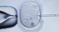Einem internationalen Forscherteam ist es gelungen, ein Mischwesen aus menschliche Stammzellen und Affen-Embryonen zu erschaffen (Symbolbild).