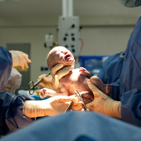 Schwere Behandlungsfehler! Säugling stirbt 7 Tage nach Geburt