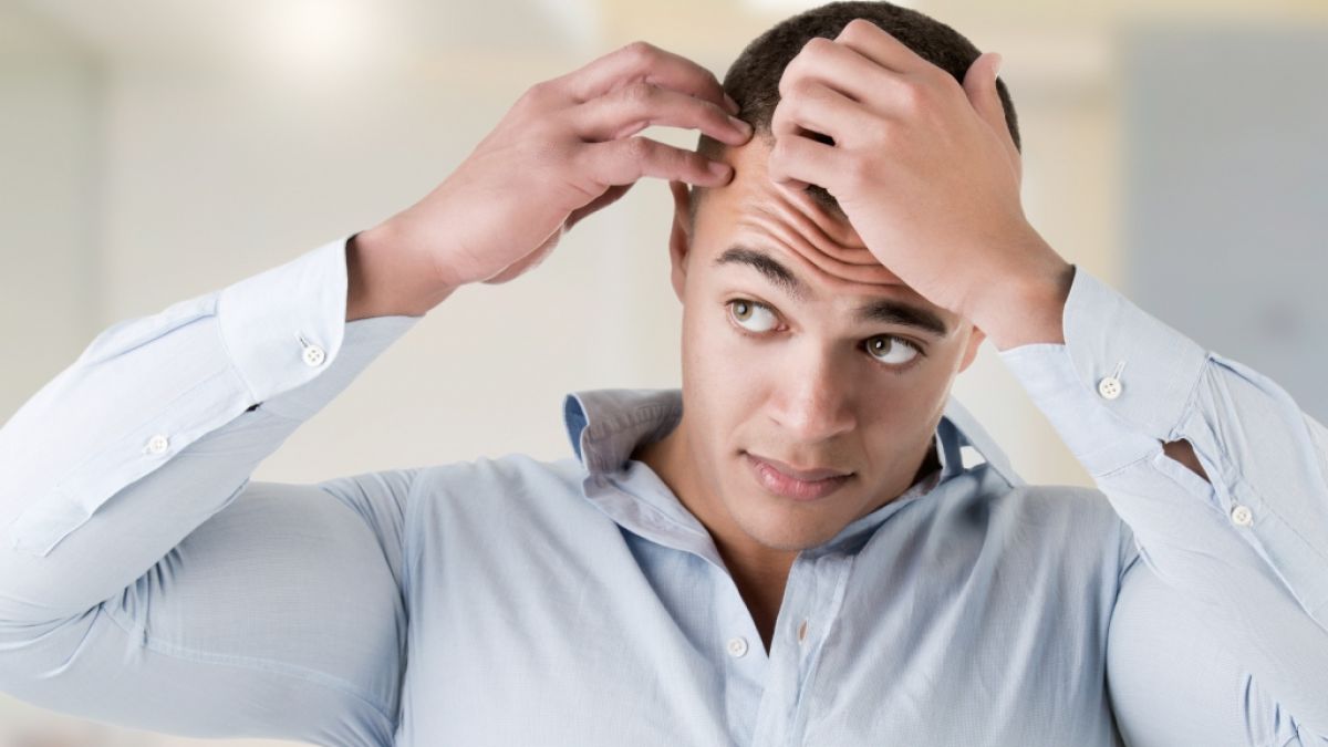 Männer mit Haarausfall haben ein 2,5 mal höheres Risiko, schwer an Corona zu erkranken.  (Foto)