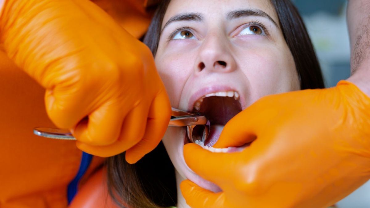 Ein Mann hat einer Frau mit den Händen die Zähne rausgerissen. (Foto)