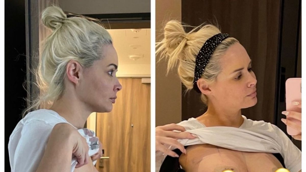 Vorher-Nachher-Vergleich: Daniela Katzenberger präsentiert auf Instagram ihre neuen Brüste. (Foto)