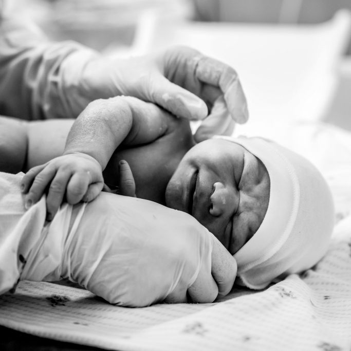 Säugling bei Kaiserschnitt aufgeschlitzt