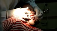 Ein kleiner Junge aus dem US-Bundesstaat Kansas ist bei einer Routinebehandlung beim Zahnarzt gestorben (Symbolbild).