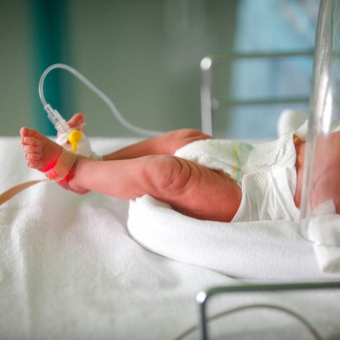 Baby erleidet Hirnschaden nach Elektroneneinsatz bei Geburt