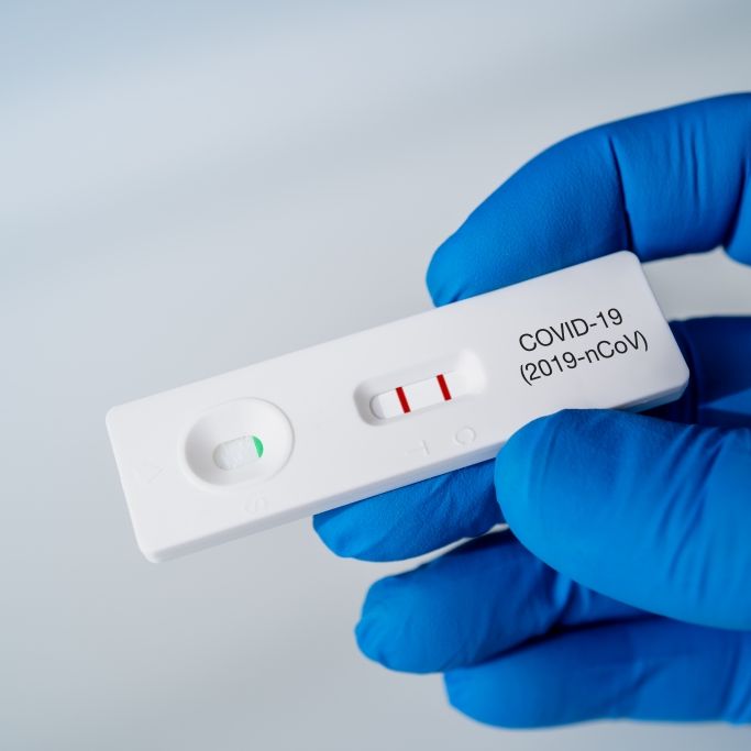 Testen wird teuer! DAS ändert sich für Ungeimpfte ab dem 11. Oktober
