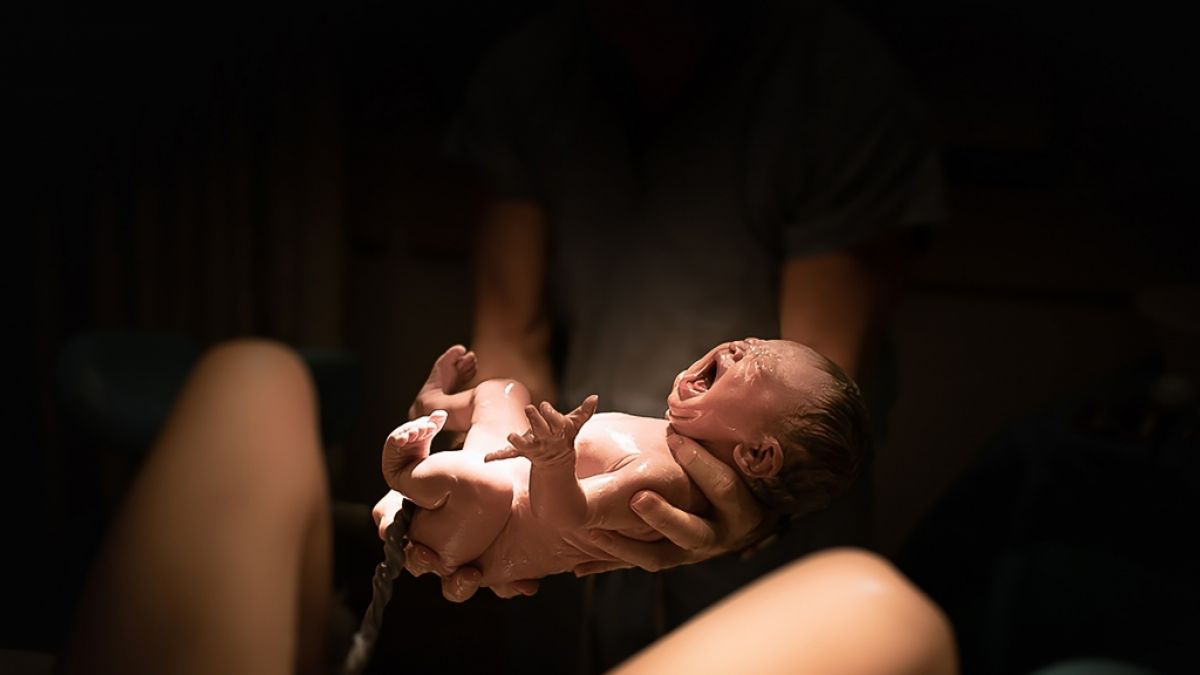 In Brasilien kam ein Baby mit einem Schwanz zur Welt. (Foto)