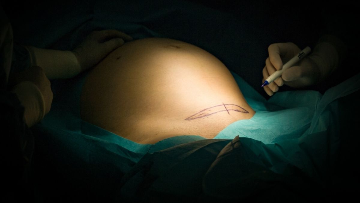 Eine Schwangere starb nach der Geburt an einer Corona-Infektion. (Foto)