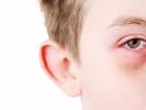 Ein neunjähriger Junge erblindete fast durch das "Covid-Auge". (Foto)