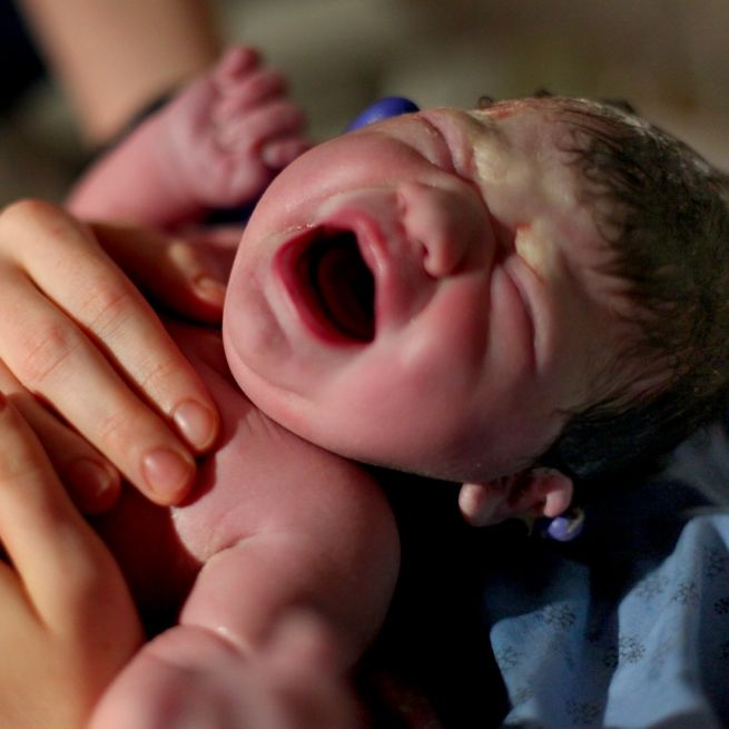 Frau bringt Baby mit vier Armen und vier Beinen zur Welt