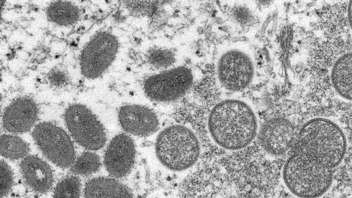 Diese elektronenmikroskopische Aufnahme aus dem Jahr 2003 zeigt reife, ovale Affenpockenviren (l) und kugelförmige unreife Virionen (r). (Foto)