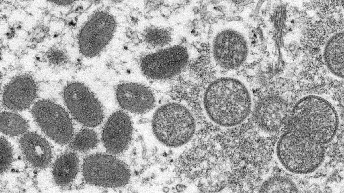 So sehen die Affenpocken-Viren unter einem Mikroskop aus. (Foto)