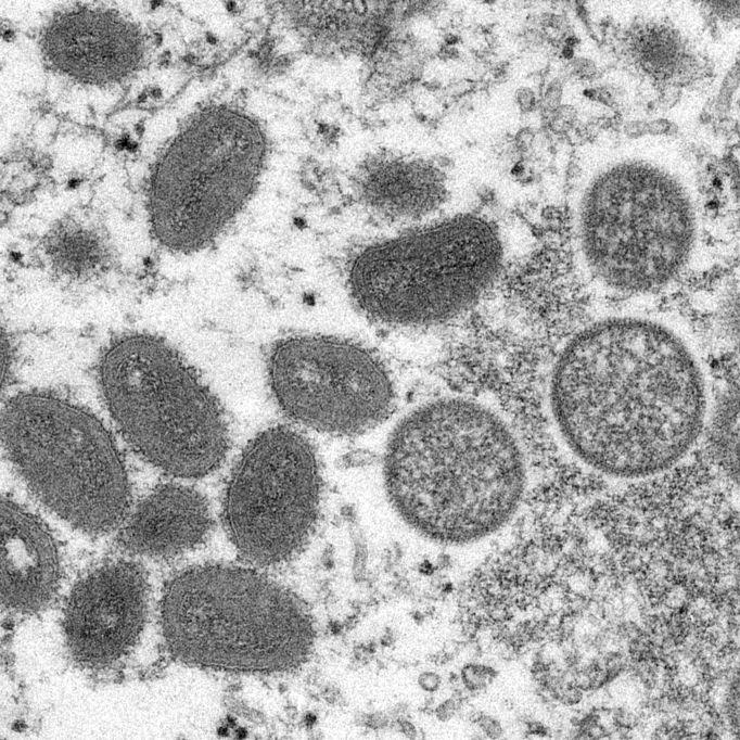 So sehen die Affenpocken-Viren unter einem Mikroskop aus.