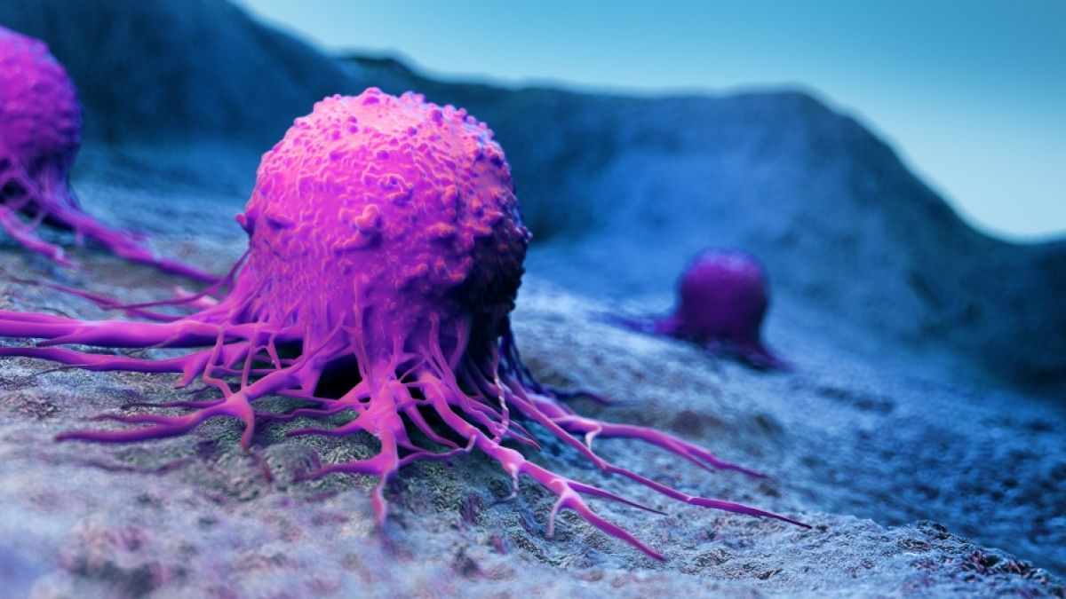 Eine Langzeitstudie aus den USA liefert jetzt neue Kenntnisse zur Entstehung von Krebs. (Foto)