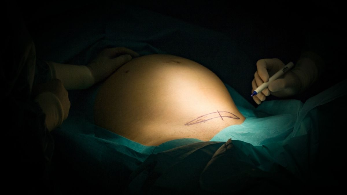 #Horror-Kaiserschnitt in Indien: Weißkittel will Putzerl 3 Monate zu Vormittag holen – Schwangere kämpft um ihr Leben