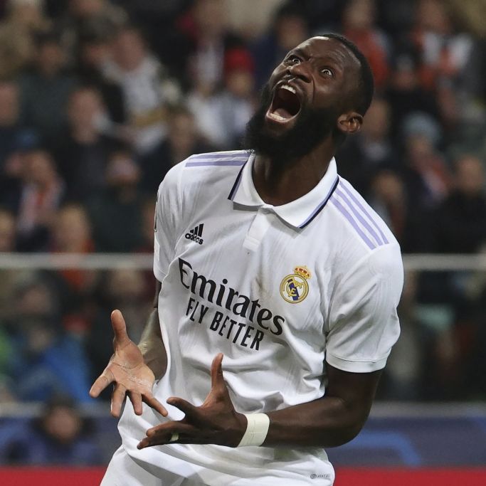 Horror-Verletzung! Real-Madrid-Star kann Auge nicht öffnen