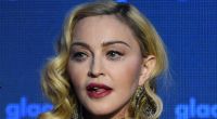 Madonnas völlig verändertes Gesicht schockte jetzt zahlreiche Grammy-Awards-Zuschauer.