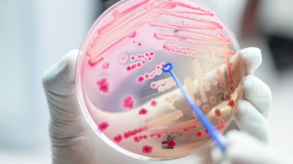 Bakterien unter der Lupe: Antiobiotikaresistenzen stellen die Medizin vor ein immer größeres Problem. (Foto)