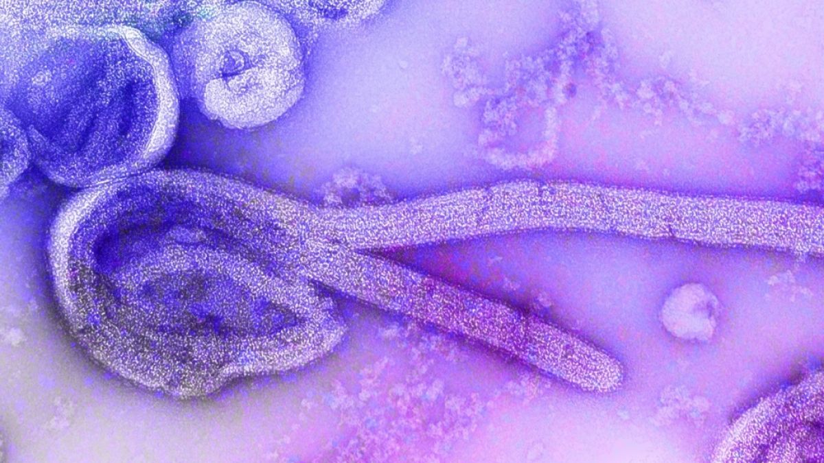 In Äquatorialguinea ist das lebensgefährliche Marburg-Fieber ausgebrochen. (Foto)