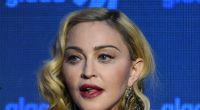 Madonnas Gesicht wirkt schon lange nicht mehr natürlich.