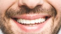 Zahnausfall kann auf Mundkrebs hindeuten. (Symbolfoto)