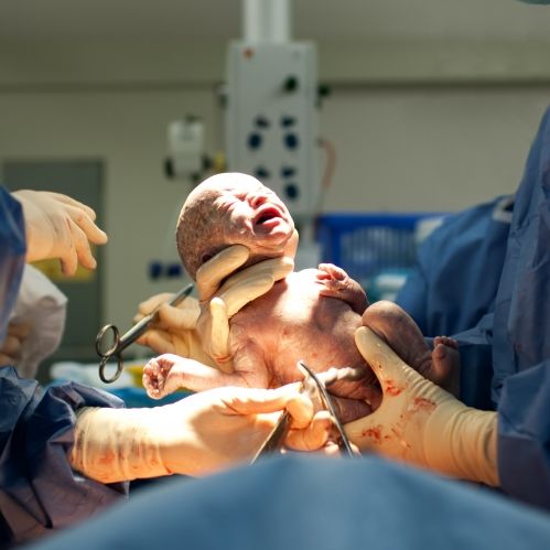 Arzt reißt Baby während Geburt den Kopf ab