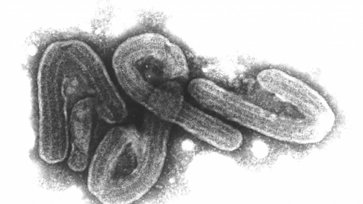 Das Marburg-Virus - hier unter dem Mikroskop zu sehen - bereitet Forschenden Kopfzerbrechen: Wird der Erreger die nächste weltweite Pandemie auslösen? (Foto)