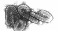 Das Marburg-Virus - hier unter dem Mikroskop zu sehen - bereitet Forschenden Kopfzerbrechen: Wird der Erreger die nächste weltweite Pandemie auslösen?