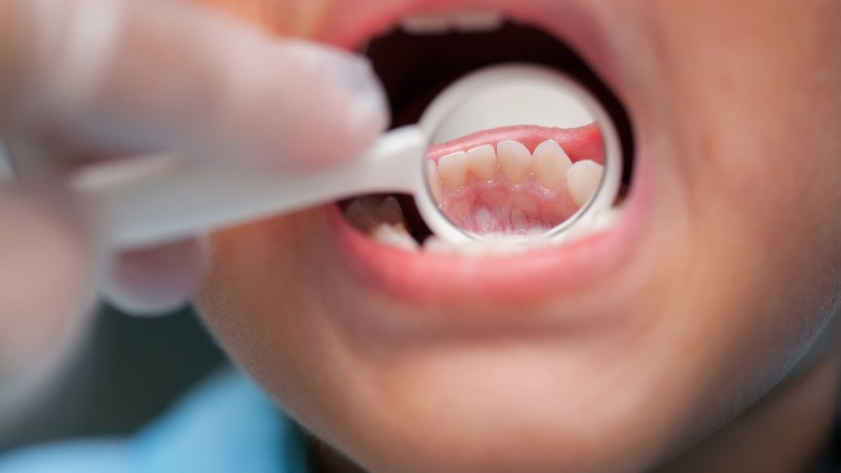 Ein ganz normaler Zahnarztbesuch endete für ein 8 Jahre altes Mädchen mit dem Tod. (Foto)
