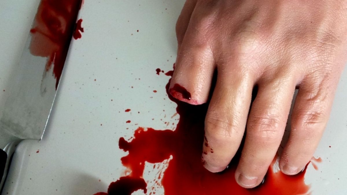 Einem Neonazi aus Chemnitz wurden jetzt drei Finger abgeschnitten. (Symbolbild) (Foto)