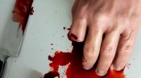 Einem Neonazi aus Chemnitz wurden jetzt drei Finger abgeschnitten. (Symbolbild)