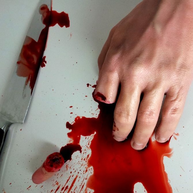 Neonazi-Finger mit Machete abgehackt! Suche nach Gliedmaßen läuft
