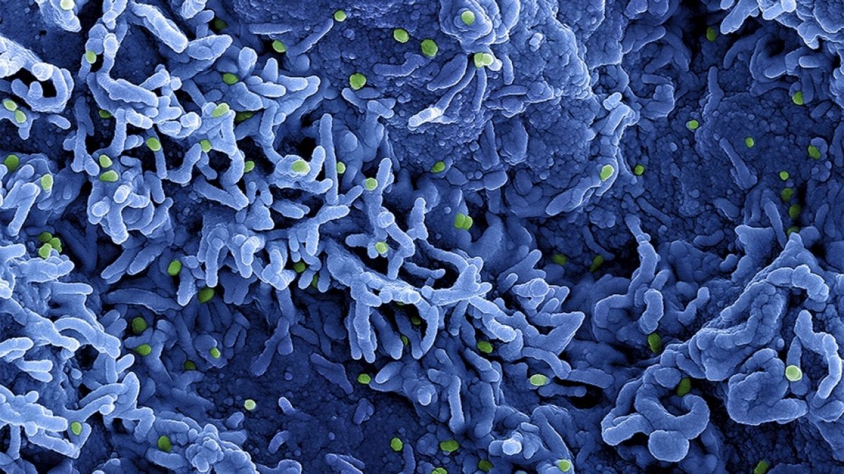In Deutschland gibt es drei neue Fälle der Viruserkrankung Mpox, früher unter Affenpocken bekannt. (Foto)