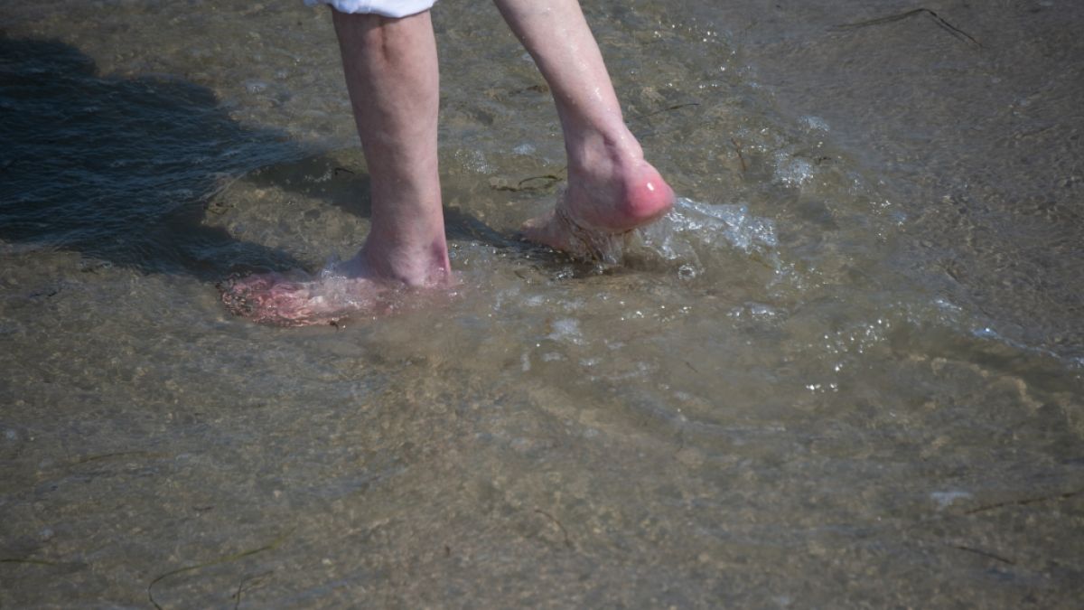 Für einen 74-Jährigen endete ein Bade-Urlaub an der Ostsee tödlich, nachdem sich der Senior mit Vibrionen infiziert hatte. (Foto)